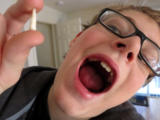 zack-tooth